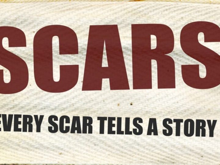 OUR FAITH…THE SCARS